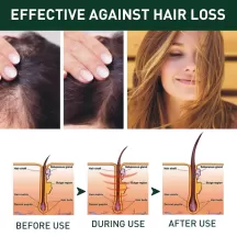West Month Ginger Hair Growth Shampoo