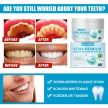 West&Month Teeth Whitening Soda Powder