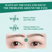 West&Month Double Eyelid Serum