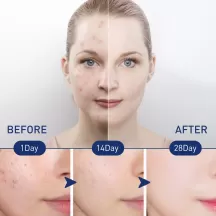 West Month Facial Exfoliating Form Mousse