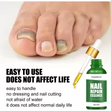 West&Month Nails Fungus Foot Serum