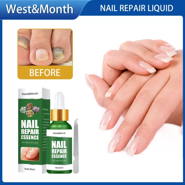 West&Month Nails Fungus Foot Serum