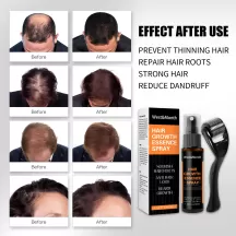 West&Month Hair Growth Essential Oil 30ml