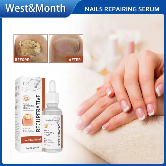 West&Month Nail Repair Liquid
