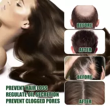 West&Month Ginger Hair Growth Serum
