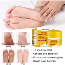 West&Month Banana Foot Crack Cream