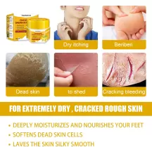 West&Month Banana Foot Crack Cream