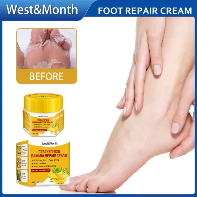 West&Month Banana Foot Crack Cream