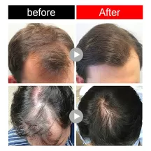 West&Month Ginger Hair Growth Cream Hair