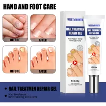 West&Month Nail Fungus Removal Cream Foot