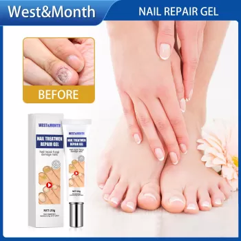 West&Month Nail Fungus Removal Cream Foot West&Month Nail Fungus Removal Cream Foot