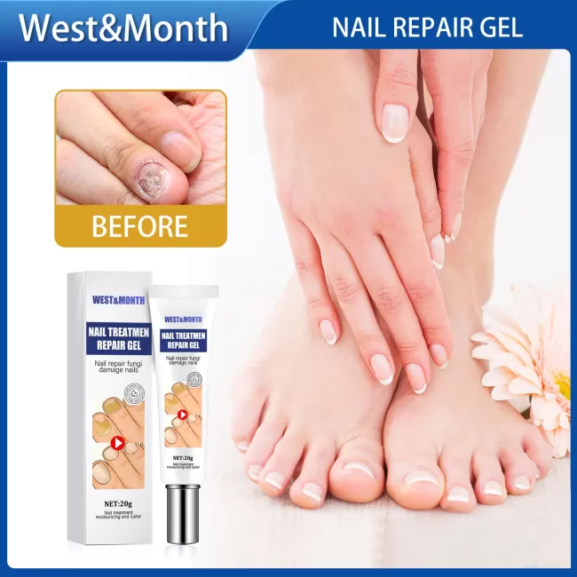 West&Month Nail Fungus Removal Cream Foot