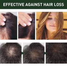 West&Month Ginger Hair Nutritional Spray