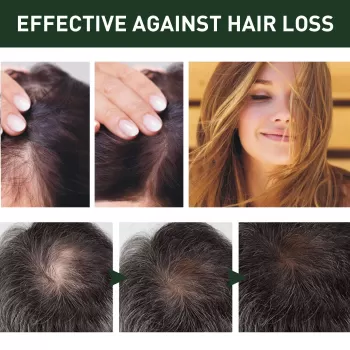 West&Month Ginger Hair Nutritional Spray West&Month Ginger Hair Nutritional Spray