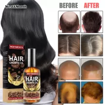 West&Month Hair Growth Essential Oil