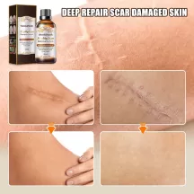 West&Month Mighty Scar Repair Essence