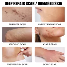 West&Month Mighty Scar Repair Essence