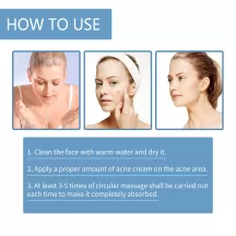 West&Month Herbal Acnes Removal Cream