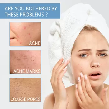 West&Month Herbal Acnes Removal Cream West&Month Herbal Acnes Removal Cream
