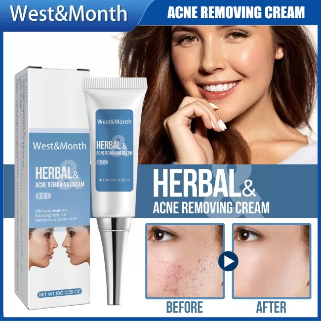 West&Month Herbal Acnes Removal Cream