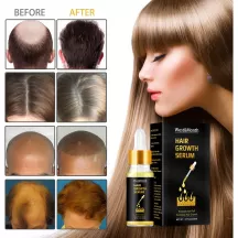 West&Month Ginseng Hair Growth Essential Oil