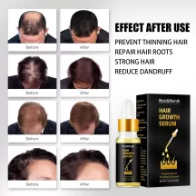 West&Month Ginseng Hair Growth Essential Oil