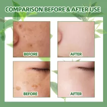 West&Month Green Tea Anti-freckle Whitening Spray