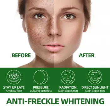 West&Month Green Tea Anti-freckle Whitening Spray West&Month Green Tea Anti-freckle Whitening Spray