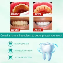 West Month Teeth Whitening Foam Toothpaste