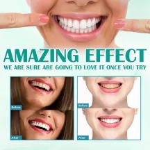 West Month Teeth Whitening Foam Toothpaste