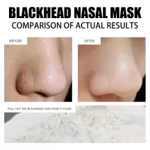 West Month Blackhead Remover Mask