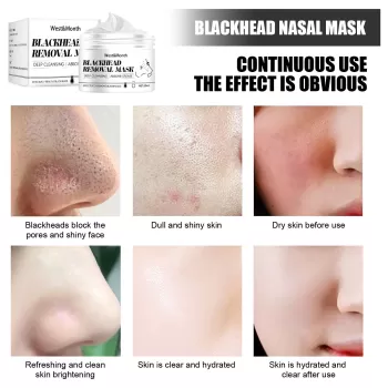 West Month Blackhead Remover Mask West Month Blackhead Remover Mask