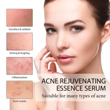West&Month Acne Rejuvenation Essene Liquid