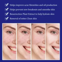 West&Month Acne Rejuvenation Essene Liquid
