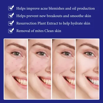 West&Month Acne Rejuvenation Essene Liquid West&Month Acne Rejuvenation Essene Liquid