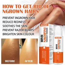 West&Month Ingrown Hairs Treatment Oil