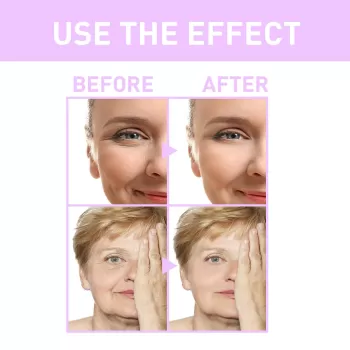 West&Month Botox Anti-wrinkle Serum West&Month Botox Anti-wrinkle Serum