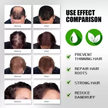 West&Month Rice Hair Essential Oil For Hair Growth