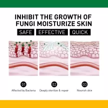 West&Month Itchy Psoriasis Cream