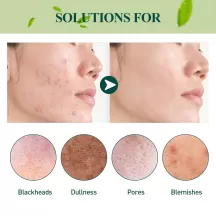 West&Month Green Tea Mask