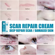 West&Month Scar Repair Cream