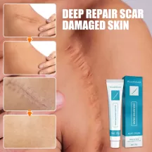 West&Month Scar Repair Cream