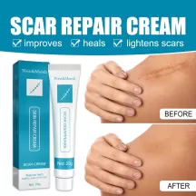 West&Month Scar Repair Cream