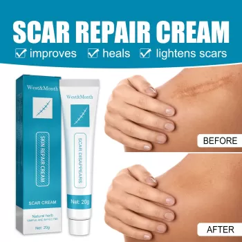 West&Month Scar Repair Cream West&Month Scar Repair Cream