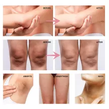 West&Month Underarm Whitening Cream For Sensitive Areas