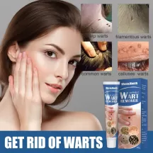 West&Month Wart Remover Skin Tags Removal Ointment