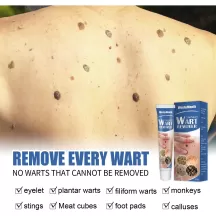 West&Month Wart Remover Skin Tags Removal Ointment