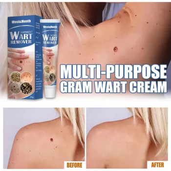 West&Month Wart Remover Skin Tags Removal Ointment West&Month Wart Remover Skin Tags Removal Ointment