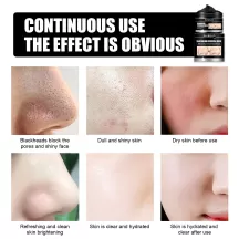 West&Month Blackhead Remover Mask