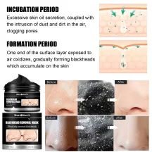 West&Month Blackhead Remover Mask